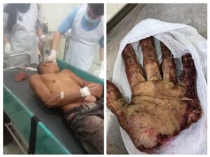 20250705_172043-COLLAGE